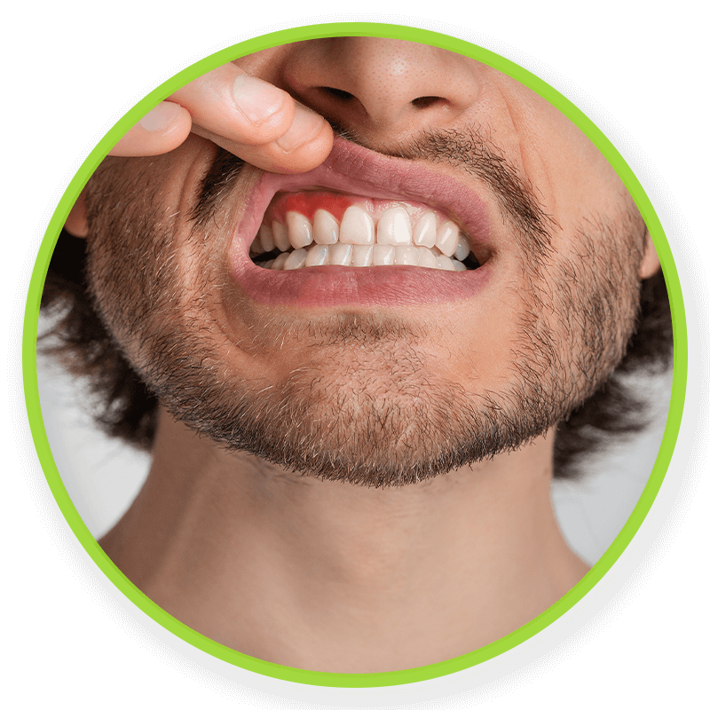 gum disease