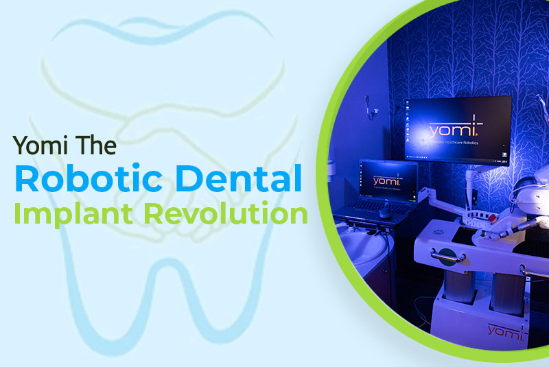 Yomi: The Robotic Dental Implant Revolution