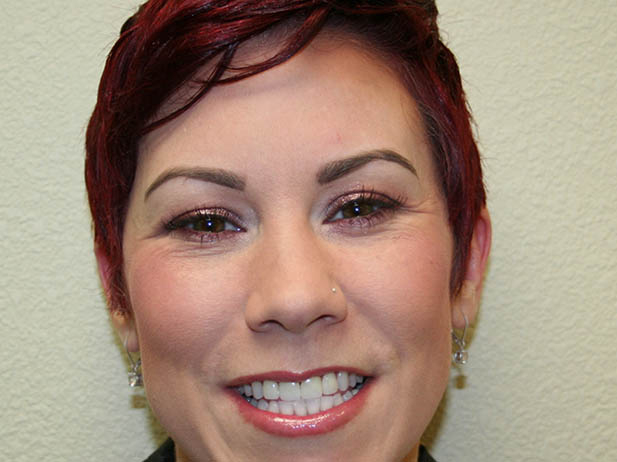 Patient smiling after dental treatment