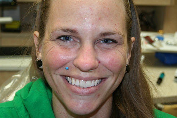 Patient smiling after dental treatment