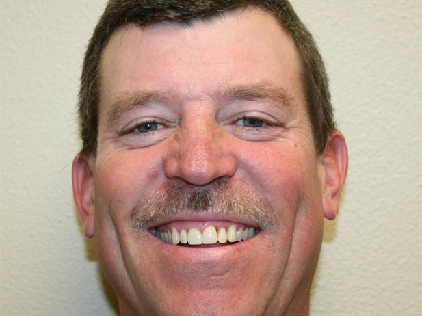 Patient smiling after dental treatment